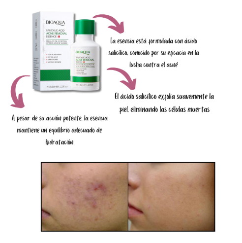 Kit Anti-Acné Acido Salicílico Bioaqua